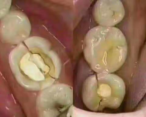 眩晕的护理