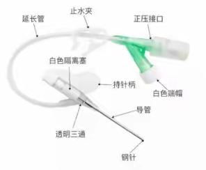 小儿静脉留置针护理