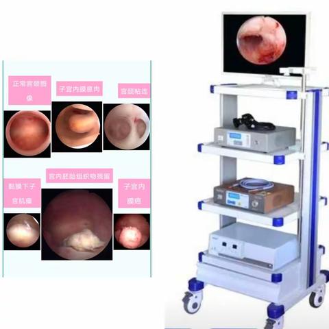 宫腔镜检查及手术