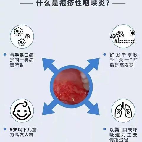 疱疹性咽峡炎、手足口病预防知识宣传—晨光楚萌未来城幼儿园