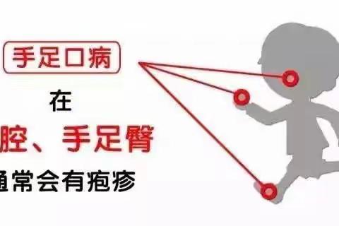 认识手足口，预防手足口——双慧幼儿园