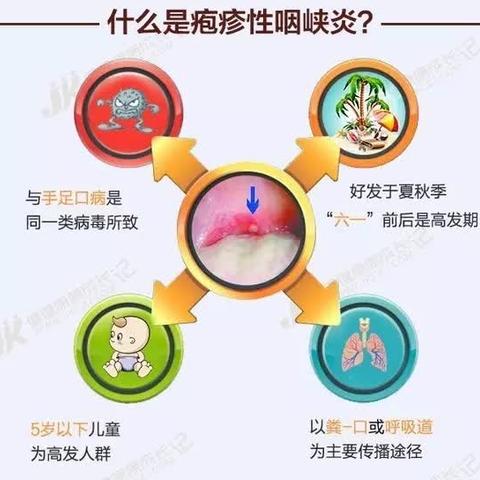 疱疹性咽峡炎 预防宣传小知识