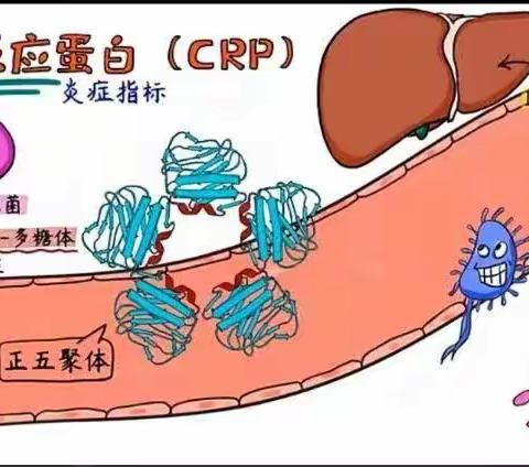 【周医-检验科】抽血时为何要做C反应蛋白测定（CRP）？