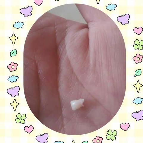 大一班绘本故事《牙齿大街的新鲜事》