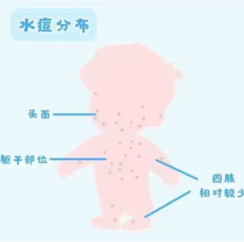 【健康知识】小太阳第三幼儿园常见传染病预防知识