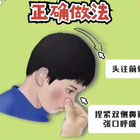 学前儿童呼吸系统的卫生与保健知识鼻子流血