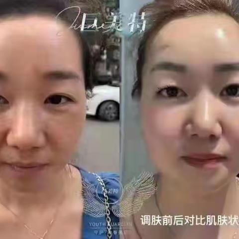 女士们，先生们！拥有一张美白脸，终于变成现实啦，快来看看吧！