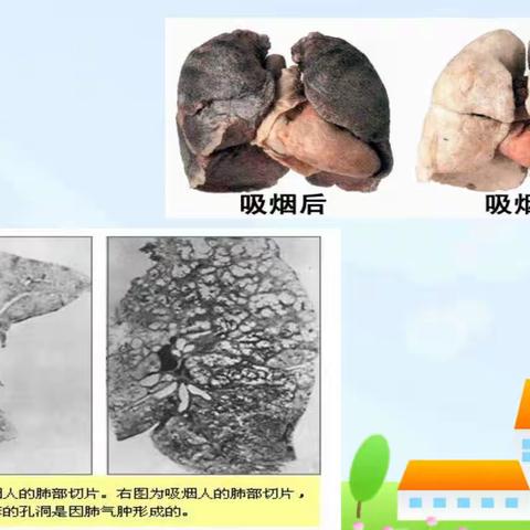 西安高新区第四十四小学召开世界无烟日主题班会