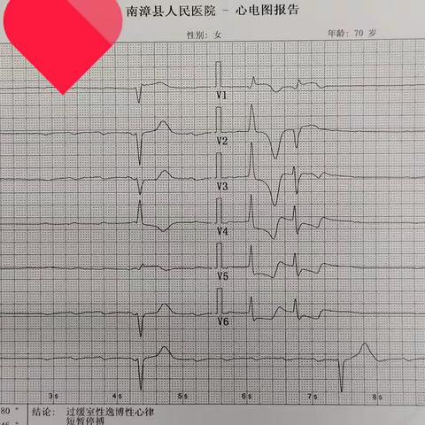 南漳县人民医院心内科成功抢救一例心律失常致晕厥患者