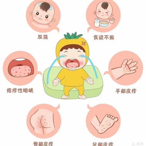 骊山骊华幼儿园《卫生保健》水痘、手足口病预防知识宣传