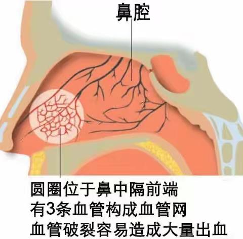 吴hh的美篇