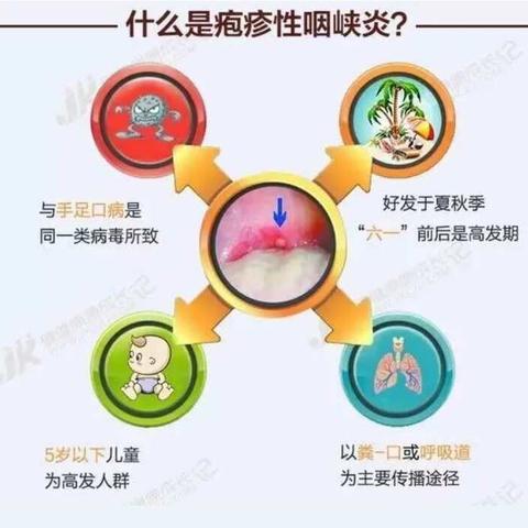 【疾病早预防】疱疹性咽峡炎