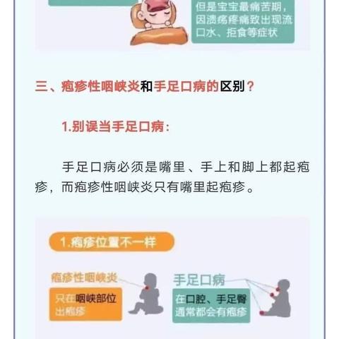 如何做好疱疹性咽峡炎防控？