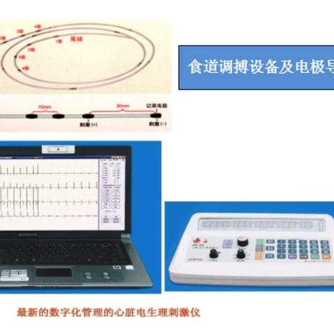 【“三抓三促”行动进行时】心内科成功开展首例食道调博电生理检查技术