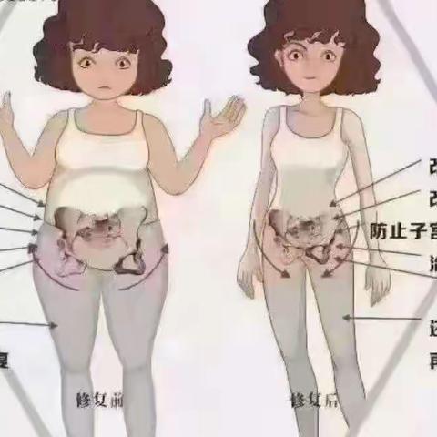 关爱女性，绽放芳华——乌兰察布市中心医院产后康复门诊推出产后康复优惠活动