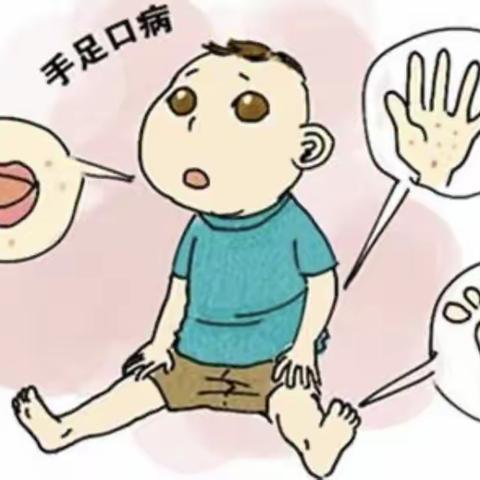 鸿府幼儿园手足口病预防告家长书