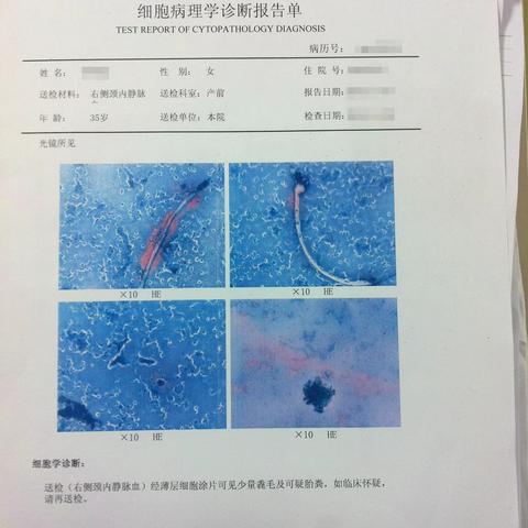 行医小故事7：梅花变桃花，春天没到桃花却凋谢了