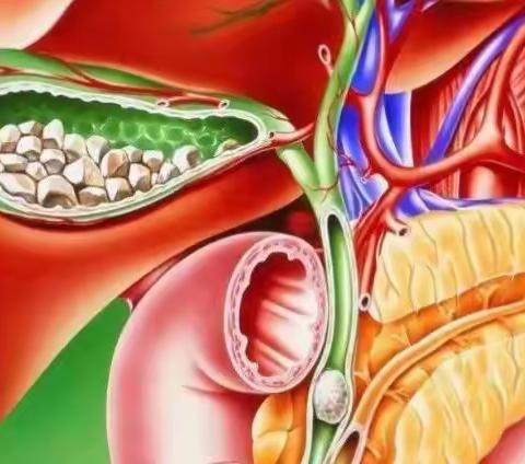 小眼睛、大世界——经腹腔镜下胆囊切除术