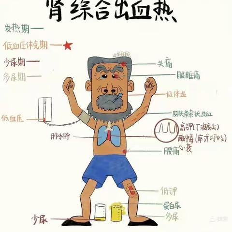 【高新教育】（疾病预防）流行性出血热---西安高新区第四十小学冯村分校