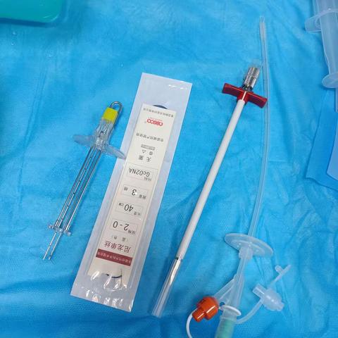 渐冻症患者胃造瘘