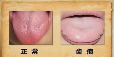 脾胃虚寒7大症状, 你中了几个?