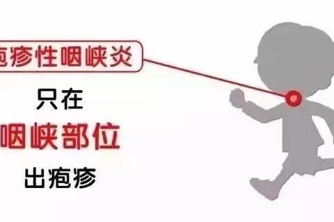 【秋季幼儿保健】疱疹性咽峡炎又来了！比手足口病还厉害！