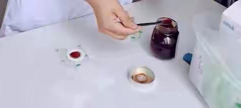 城南医院肝病科开展中医特色治疗——穴位贴敷疗法