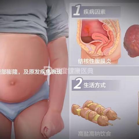 城南医院肝病科特色无创治疗腹水，给你意想不到的惊喜。