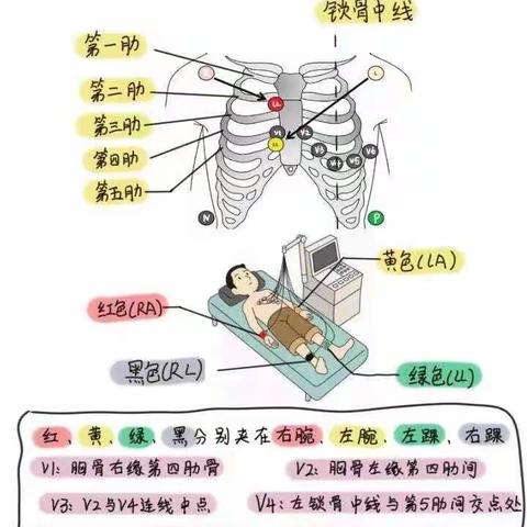 心电图检查与注意事项