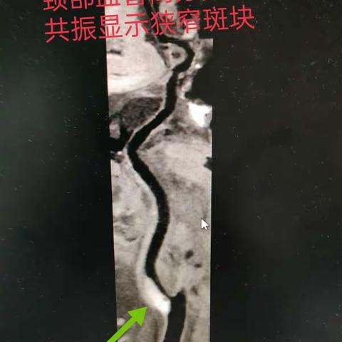 风云的美篇