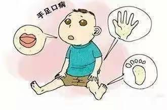 幼儿手足口病预防知识