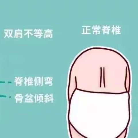 孩子脊柱侧弯了吗？