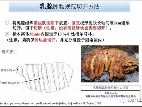 病理组织固定那些事儿