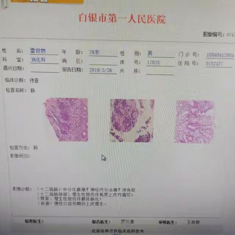 消化科MDT讨论病例