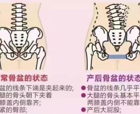 #为什么要做骨盆还原