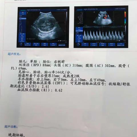 2016，你在粑粑麻麻的孕育下悄悄地来了！我们在惊喜，担心，喜悦，期待中把你盼来了-致我们的嘟嘟宝贝