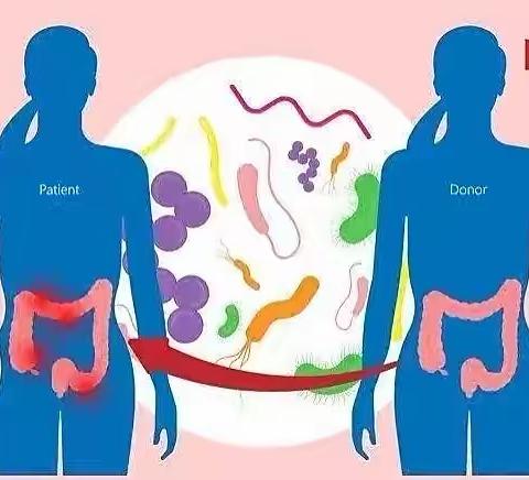 粪菌移植治疗炎症性肠病的现状及安全性