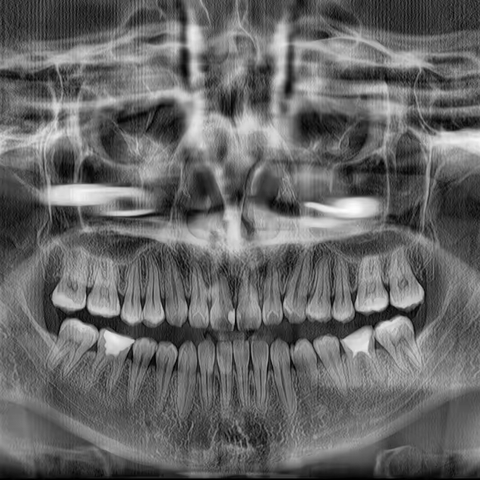 一次性成像大视野CBCT