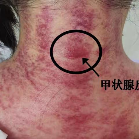 成人刮痧半价体验活动