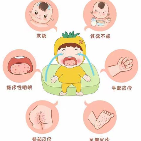 预防手足口病——平果市青苗幼儿园保健小课堂