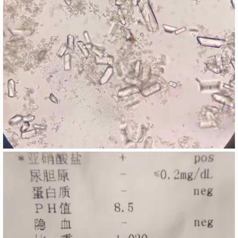 尿液“送信者”—磷酸铵镁结晶