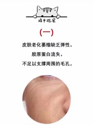 夏天护肤专题主题：夏天毛孔如何护理？附带自己研发的护肤技巧（干货分享）