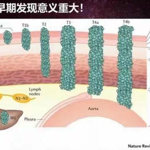 消失吧！肿瘤君！