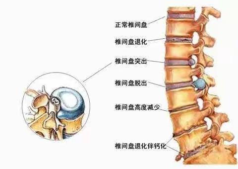 不良习惯  “腰”你好看