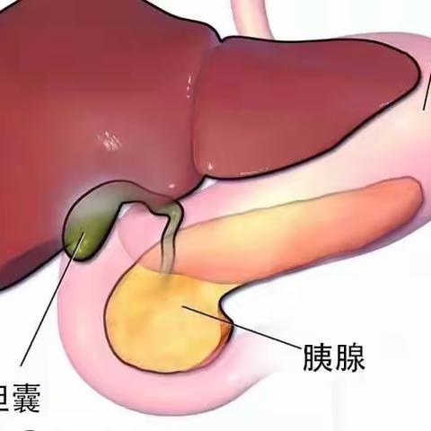 胆囊切除术后需要注意哪些？