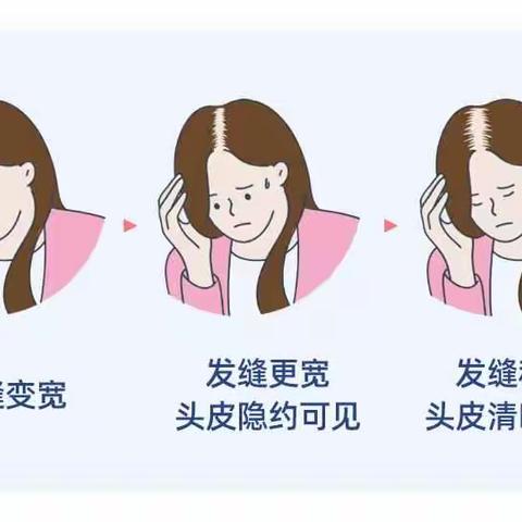 女性发缝宽怎么办？3招帮你改善发缝宽