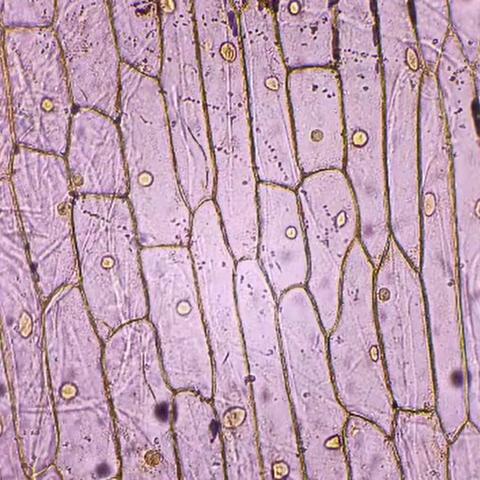 观察洋葱内表皮细胞––––我们的第二次生物实验课