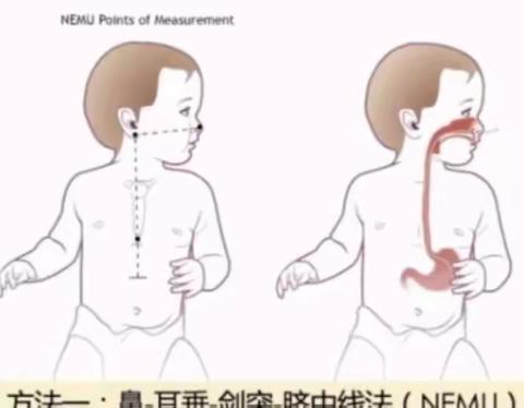 🌻“我喜欢的专家”讲儿童管饲