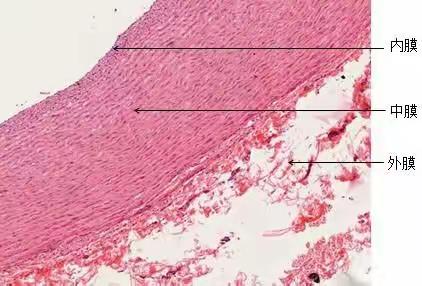 大动脉显微结构