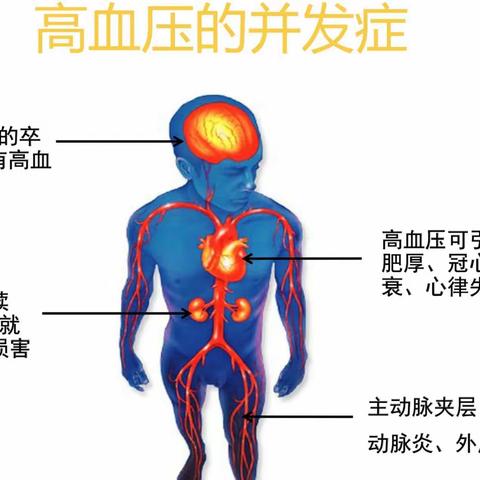 高血压生活管理指南，涉及方方面面！收藏！